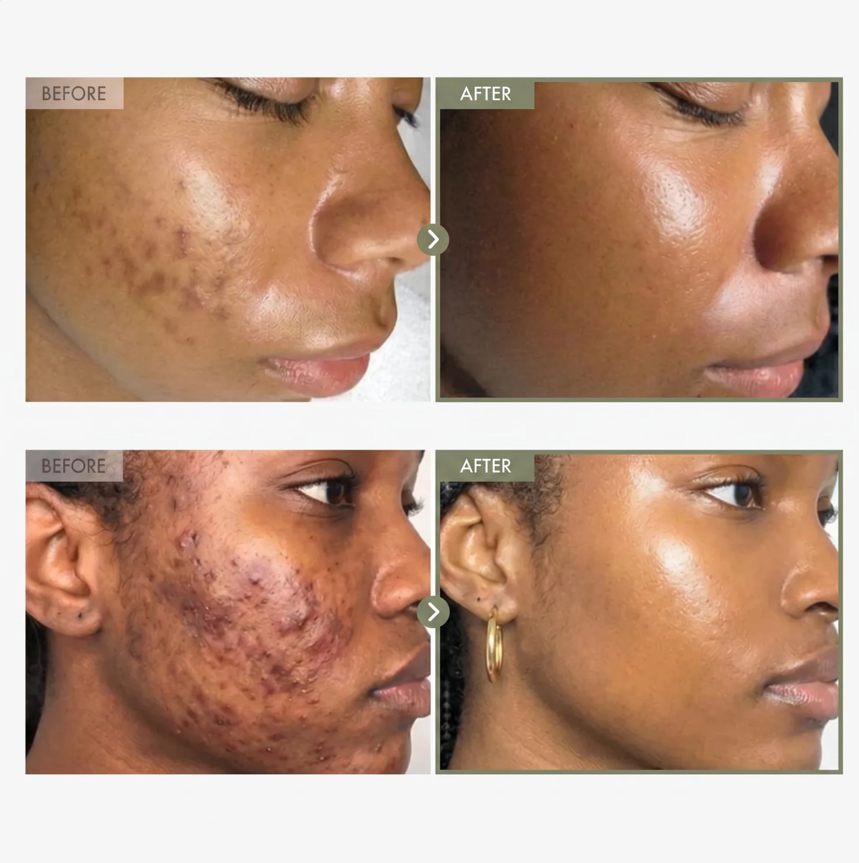 Glynova™ Liposomal Glutathione
